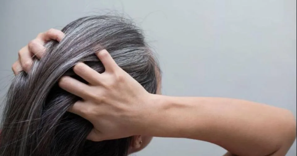 The Causes of White Hair and Easy Ways To Prevent It Naturally